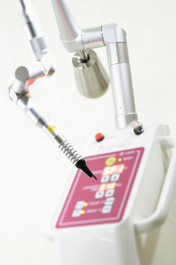 炭酸ガスレーザー（CO₂レーザー）